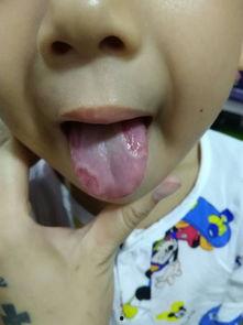 吃角瓜舌头痒,吃角瓜引发的神秘瘙痒之谜